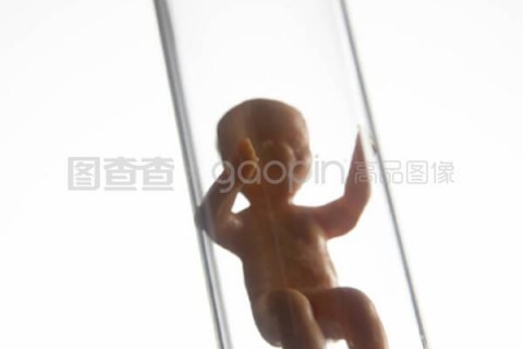 成都捐卵宝宝眼屎多的原因